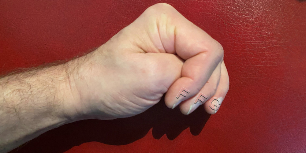 20241219 Daumen Gedrückt Halten 03